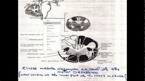 Neuroanatomy - Lecture 7 (PART 2) - YouTube