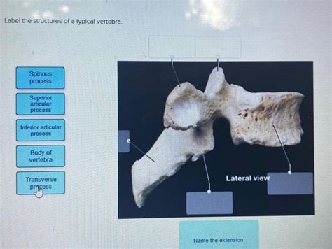 Solved Label The Structures Of A Typical Vertebra Spinous