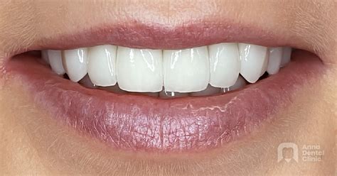 Anna | Anna Dental Clinic