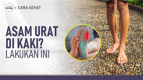 Nyeri Asam Urat Di Kaki Lakukan Terapi Sederhana Ini Hidup Sehat