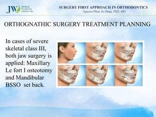 Surgery First Approach In Orthodontics Ppt