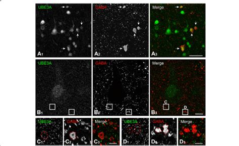 UBE3A Expression In GABAergic Neurons In Temporal Cortex From A Human