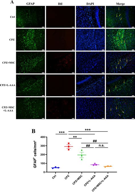 Immunofluorescence Staining Of GFAP Astrocyte Marker In The Corpus