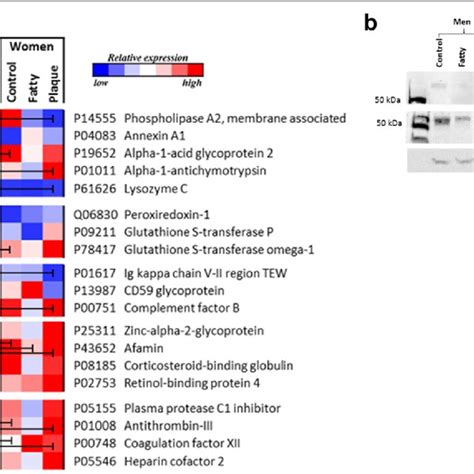 Altered Sex Specific Proteins Show Significant Differences In Matched Download Scientific