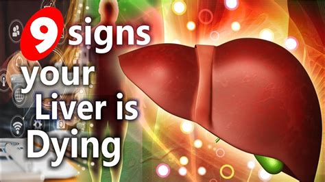 9 Signs Of Dying Liver Liver Disease Signs 9 Warning Signs Your Liver Is Dying Youtube