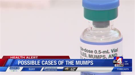 2 Cases Reported As Mumps Cases Rise In Utah