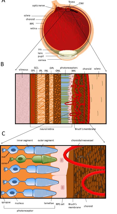 Choroidal Neovascular Membrane Diagram