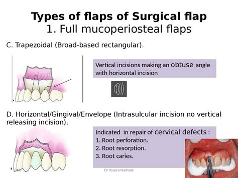 Endodontic Surgery Online Presentation