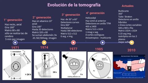 Evoluci N De La Tomograf A