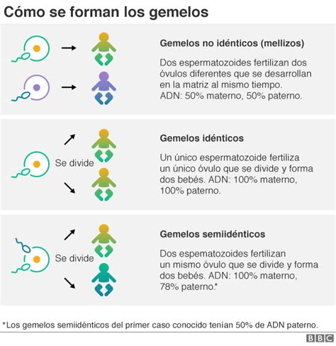 El Extra O Caso De Los Gemelos Semiid Nticos Que Sobrevivieron Pese A