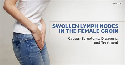 What Does A Swollen Lymph Node In The Female Groin Indicate