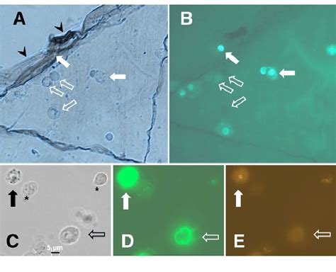 Hemocytes In The Clot Show Hallmarks Of Apoptosis Bright Field A And