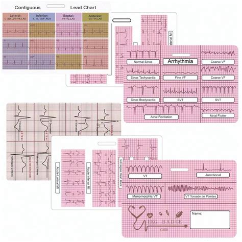 Ekg Cardiac Badge Card Card Set Stemi Badge Card Ekg Telemetry