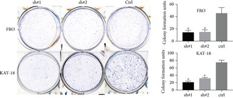 The Knockdown Of Nrf2 Suppressed Tumor Growth And Increased The