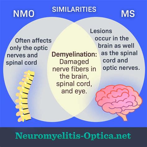 Common Misdiagnoses Ms And Nmo Neuromyelitis