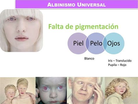 Anomalías humanas ligadas a los cromosomas sexuales PPT Descarga