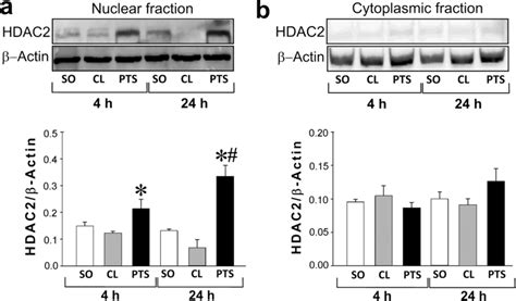 Expression Of Hdac In The Nuclear And Cytoplasmic Fractions B Of