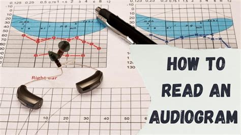 How To Read An Audiogram Hearclear Hearing