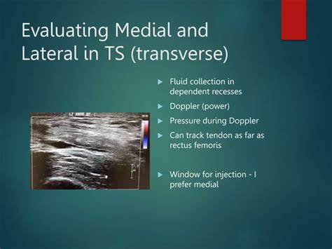 Knee Diagnostic Msk Ultrasoundpptx