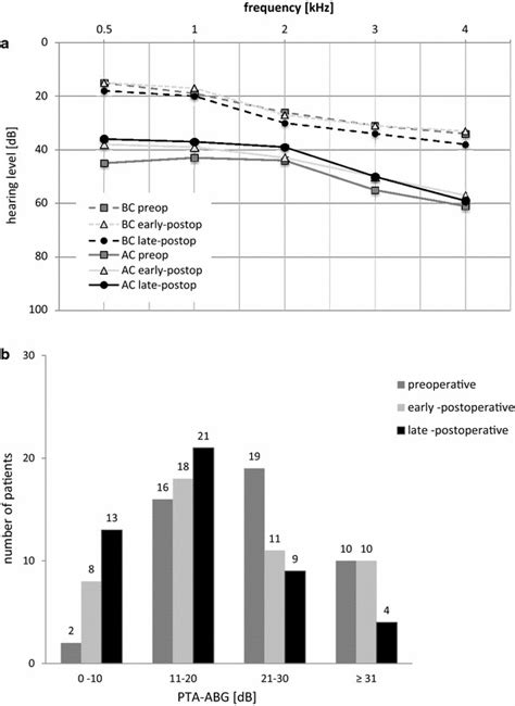 Mean Air Conduction Ac And Bone Conduction Bc Of All Evaluated Ears Download Scientific