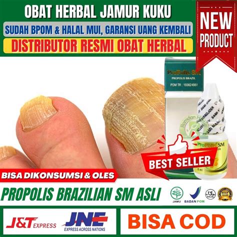 Jual Obat Infeksi Jamur Kuku Tinea Unguium Onkomikosis Kutu Air