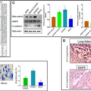 MiR 320a Promotes A549 Cell Migration Invasion And EMT A Cell