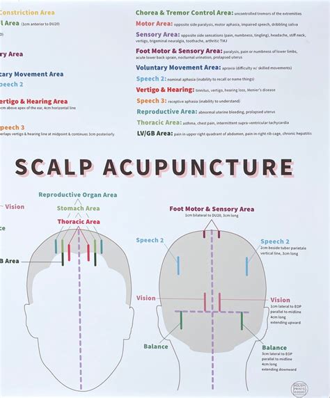 Scalp Acupuncture Print 19 x 13 Chinese | Etsy