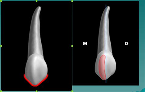 PERMANENT CANINE CLASS TRAITS *LABIAL* ASPECT Diagram | Quizlet