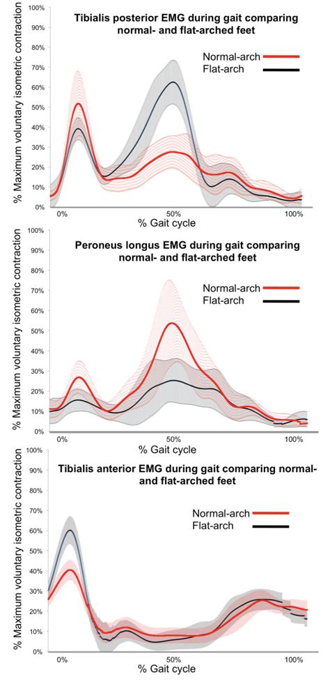 Ensemble Averaged Emg Curves For Tibialis Posterior Peroneus Longus