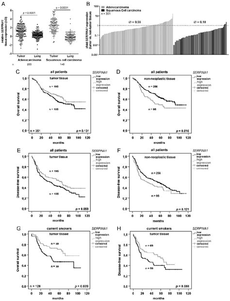 Serpina1 Expression Is Downregulated In Nsclc And Is A Prognostic