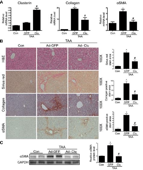 Adenovirus Mediated Overexpression Of Clusterin Ameliorates Hepatic