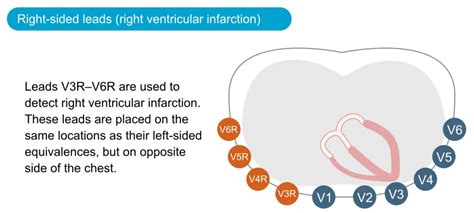 The Ecg Leads Electrodes Limb Leads Chest Precordial Leads And The