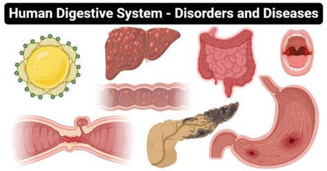 Disorders And Diseases Of The Human Digestive System