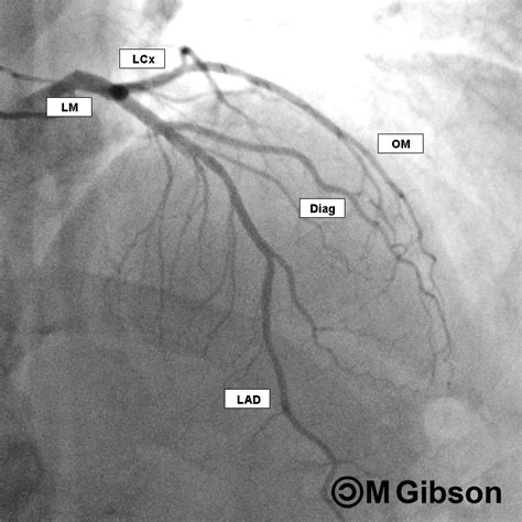 Med School, Nursing School, Cath Lab Nursing, Arteries Anatomy, Medical ...