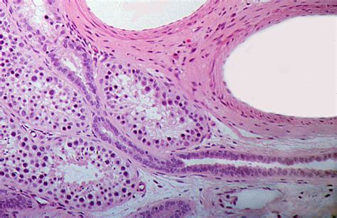 Hls Male Reproductive System Testis Tubulus Rectus High Mag