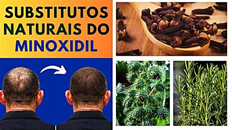 SUBSTITUTOS NATURAIS DO MINOXIDIL YouTube