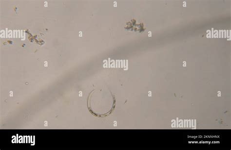 Nematode Worm Under Microscope, Parasites Among Roundworms: Roundworms ...