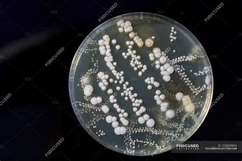 Petri Dish Bacteria Identification