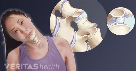 Neck Cracking And Grinding What Does It Mean