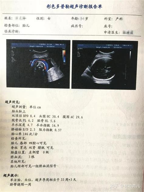 孕期5次b超何时做、查什么、结果怎么看 读懂这篇就明白了！ 知乎