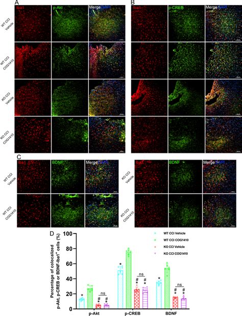 Activation Of The Akt Creb Bdnf Signalling Axis Occurred In Microglia