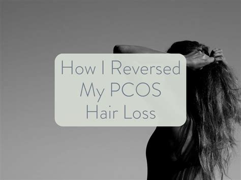 How I Reversed My Pcos Hair Loss Naturally The Pcos Nutritionist Alyssa