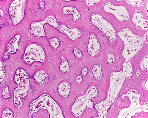 Intramembranous Ossification Photograph By Jose Calvo Science Photo