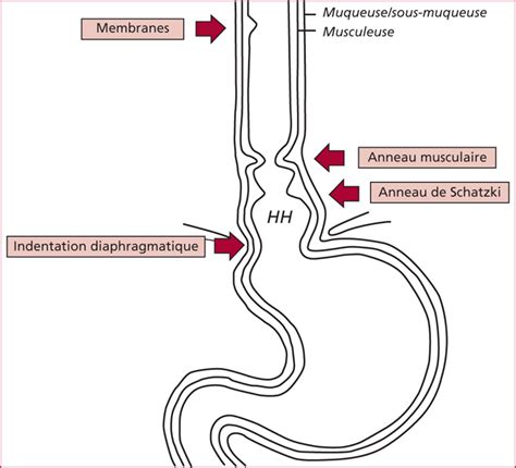 JLE Hépato Gastro Oncologie Digestive Anneaux et membranes de l