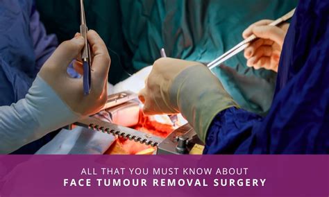 Everything You Must Know About Face Tumor Removal Surgery