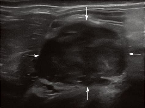 Feline Abdominal Ultrasonography Whats Normal Whats Abnormal Abdominal Lymph Nodes