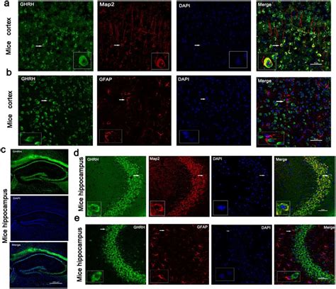 Localization Of Ghrh In The Mouse Cortex And Hippocampus A D Ghrh