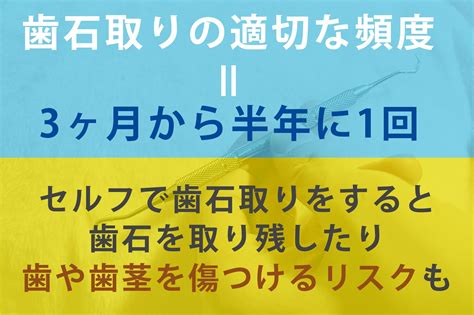 歯石取りの頻度について｜歯科医院で施術を受けるべき理由を解説【清誠歯科】大阪なんば・東住吉・八尾・松原