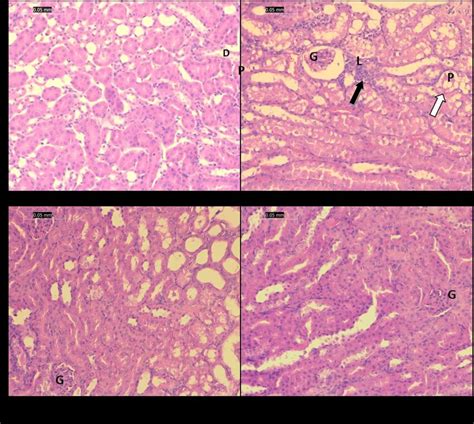 Photomicrographs Of The Renal Cortex Sections Stained By Hematoxylin