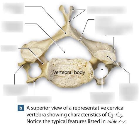 Typical Cervical Vertebra Superior View